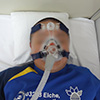 CPAP治療写真2
